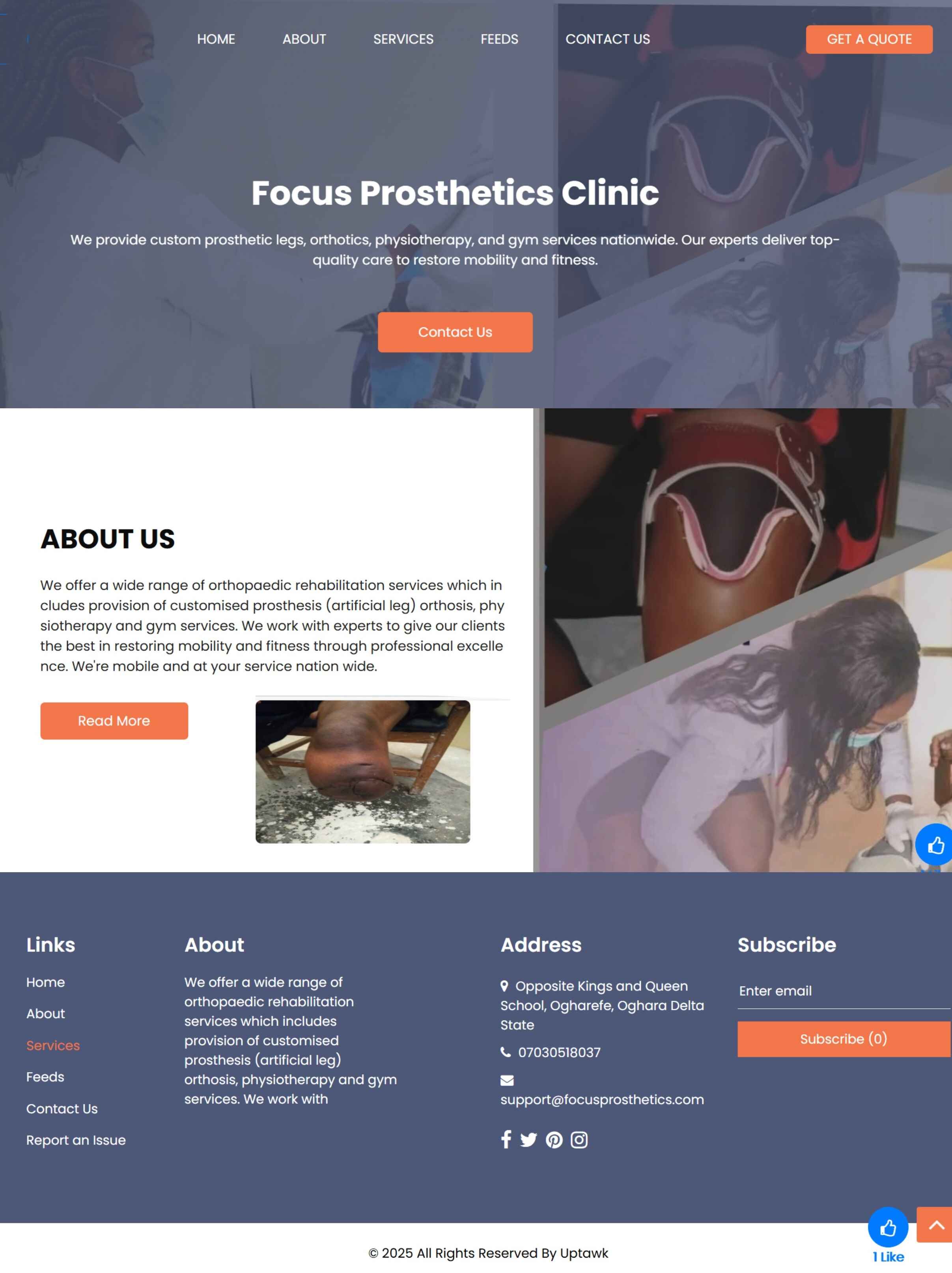 Focus Prosthetics.